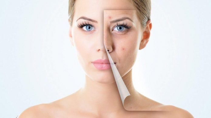 RETINOIDS TRONG ĐIỀU TRỊ MỤN TRỨNG CÁ