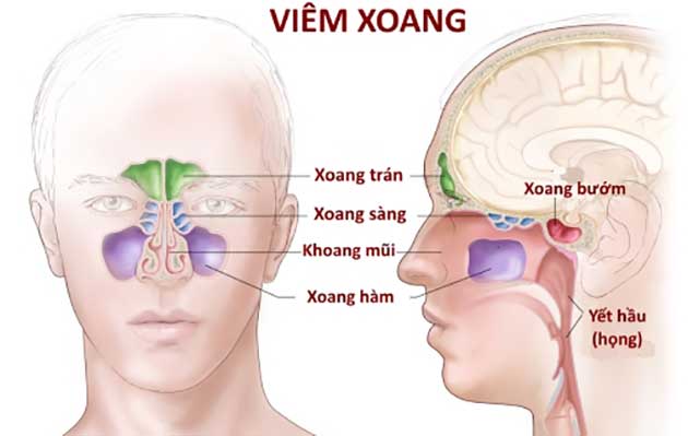 VIÊM XOANG